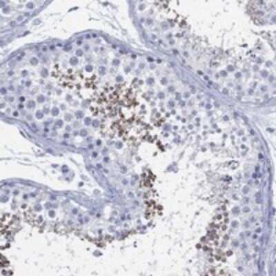 Immunohistochemistry-Paraffin: TMEM247 Antibody [NBP3-17179] - Staining of human testis shows strong cytoplasmic positivity in cells in seminiferous ducts.