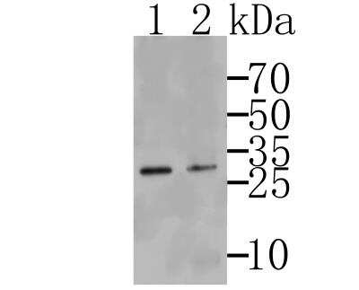Western Blot: TMEM248 Antibody [NBP2-76967] - Western blot analysis of Tmem248 on SkBr3 (1) and K562 cells lysates using anti-Tmem248 antibody.