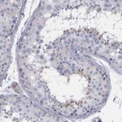 Immunohistochemistry-Paraffin: TMEM249 Antibody [NBP3-17180] - Staining of human testis shows strong positivity in spermatids.