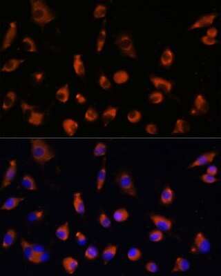 Immunocytochemistry/ Immunofluorescence TMEM25 Antibody - Azide and BSA Free