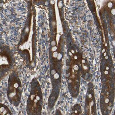 Immunohistochemistry-Paraffin: TMEM25 Antibody [NBP1-82237] - Staining of human duodenum shows strong cytoplasmic positivity in glandular cells.