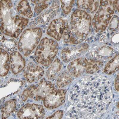 Immunohistochemistry-Paraffin: TMEM25 Antibody [NBP1-82237] - Staining of human kidney shows moderate cytoplasmic positivity in cells in tubules.