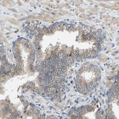 Immunohistochemistry-Paraffin: TMEM25 Antibody [NBP1-82237] - Staining of human prostate shows weak cytoplasmic/ membranous positivity in glandular cells.