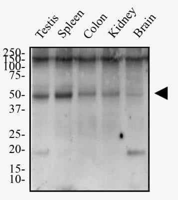 Western Blot TMEM26 Antibody - BSA Free