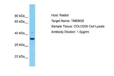 Western Blot TMEM26 Antibody - BSA Free