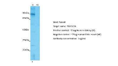 Western Blot TMEM26 Antibody - BSA Free