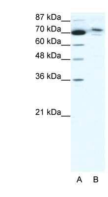 Western Blot: TMEM260 Antibody [NBP1-91525] - HepG2 cell lysate, concentration 0.125ug/ml.