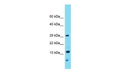 Western Blot: TMEM261 Antibody [NBP2-83689] - Host: Rabbit. Target Name: C9orf123. Sample Type: U937 Whole Cell lysates. Antibody Dilution: 1.0ug/ml
