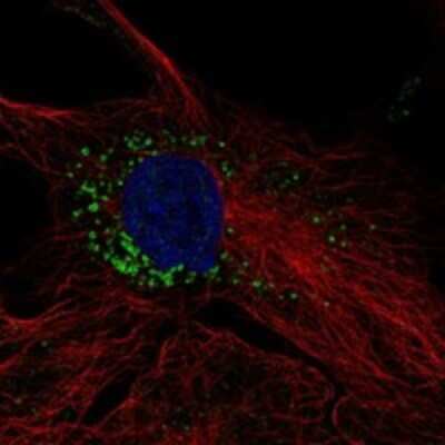Immunocytochemistry/Immunofluorescence: TMEM263 Antibody [NBP3-17552] - Staining of human cell line hTERT-RPE1 shows localization to vesicles.