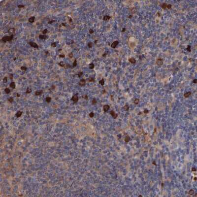 Immunohistochemistry-Paraffin: TMEM268 Antibody [NBP1-90535] - Staining of human lymph node shows strong cytoplasmic/ membranous positivity in a small subset of lymphoid cells.
