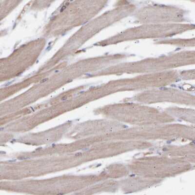 Immunohistochemistry-Paraffin: TMEM268 Antibody [NBP1-90535] - Staining of human skeletal muscle shows very weak positivity in myocytes as expected.
