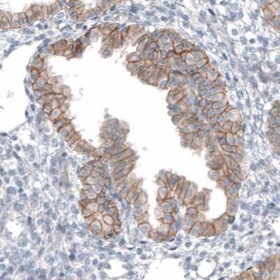 Immunohistochemistry-Paraffin: TMEM30A Antibody [NBP1-86739] - Staining of human endometrium shows moderate to strong membranous positivity in glandular cells.