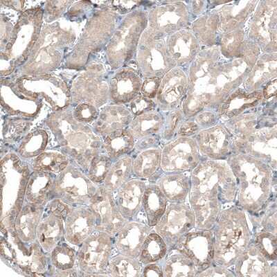 Immunohistochemistry-Paraffin: TMEM30A Antibody [NBP1-86739] - Staining of human kidney shows moderate to strong membranous positivity in cells in tubules.