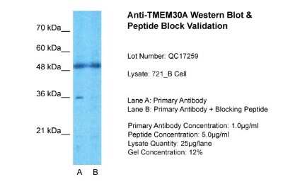 Western Blot: TMEM30A Antibody [NBP1-59474] - Sample Tissue: 721_B, Lane A: Primary Antibody, Lane B: Primary Antibody + Blocking Peptide, Primary Antibody Concentration: 1ug/ml, Peptide Concentration: 5ug/ml, Lysate Quantity: 25ug/lane/lane, Gel Concentration: 0.12