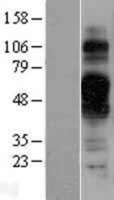 Western Blot: TMEM30B Overexpression Lysate (Adult Normal) [NBL1-17070] Left-Empty vector transfected control cell lysate (HEK293 cell lysate); Right -Over-expression Lysate for TMEM30B.