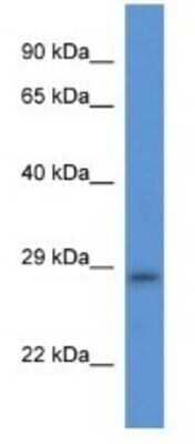 Western Blot: TMEM33 Antibody [NBP1-74217] - Rat Heart Lysate 1ug/ml Gel Concentration 12%