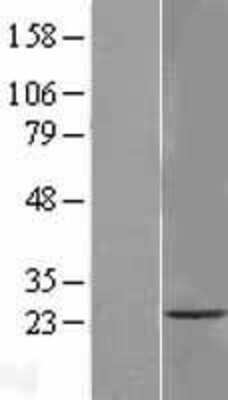 Western Blot: TMEM33 Overexpression Lysate (Adult Normal) [NBL1-17073] Left-Empty vector transfected control cell lysate (HEK293 cell lysate); Right -Over-expression Lysate for TMEM33.