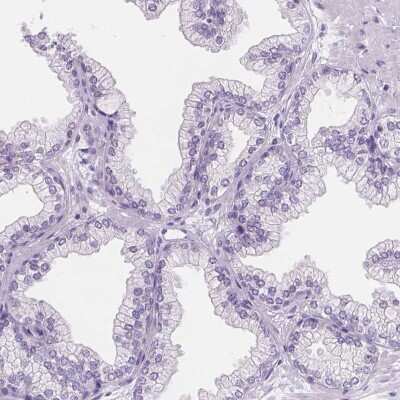 Immunohistochemistry-Paraffin TMEM38A Antibody