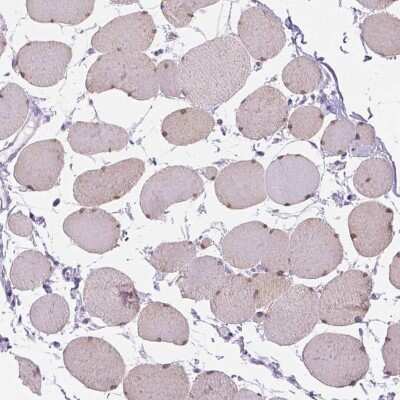 Immunohistochemistry-Paraffin TMEM38A Antibody