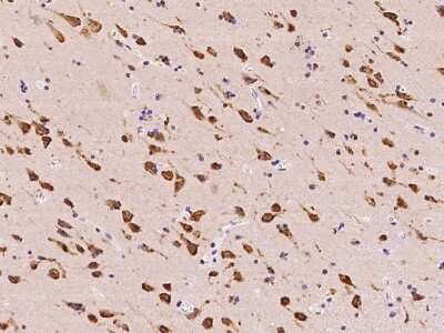 Immunohistochemistry-Paraffin TMEM38A Antibody - BSA Free