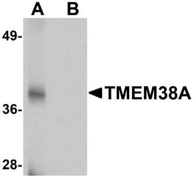 Western Blot TMEM38A Antibody - BSA Free