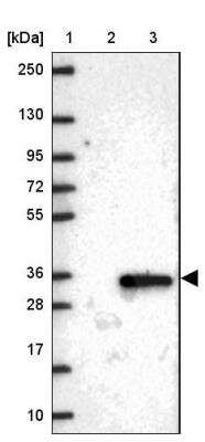 Western Blot TMEM38A Antibody