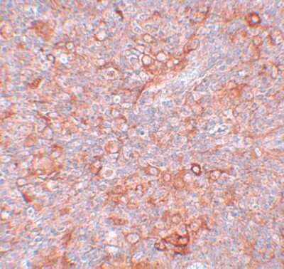 Immunohistochemistry-Paraffin TMEM38B Antibody - BSA Free