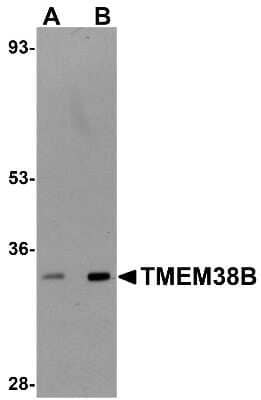 Western Blot TMEM38B Antibody - BSA Free