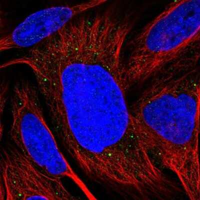 Immunocytochemistry/ Immunofluorescence TMEM39B Antibody - BSA Free