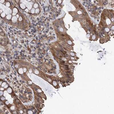Immunohistochemistry-Paraffin TMEM39B Antibody - BSA Free