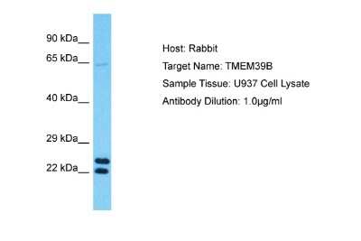 Western Blot TMEM39B Antibody - BSA Free
