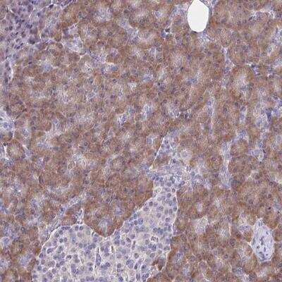Immunohistochemistry-Paraffin: TMEM41A Antibody [NBP2-31796] - Staining of human pancreas shows moderate cytoplasmic positivity in exocrine glandular cells.