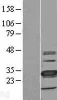 Western Blot: TMEM41A Overexpression Lysate (Adult Normal) [NBL1-17078] Left-Empty vector transfected control cell lysate (HEK293 cell lysate); Right -Over-expression Lysate for TMEM41A.