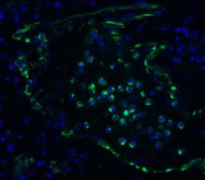 Immunohistochemistry: TMEM41B Antibody [NBP3-12857] - Immunofluorescent analysis of 4% paraformaldehyde-fixed human lung labeling TMEM41B with NBP3-12857 at 20 ug/mL, followed by goat anti-rabbit IgG secondary antibody at 1/500 dilution (green) and DAPI staining (blue).