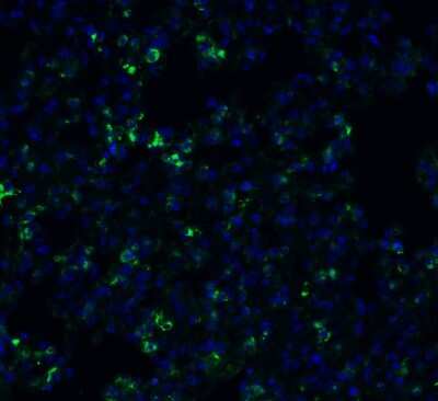 Immunohistochemistry: TMEM41B Antibody [NBP3-12858] - Immunofluorescent analysis of 4% paraformaldehyde-fixed rat lung labeling TMEM41B with NBP3-12858 at 20 ug/mL, followed by goat anti-rabbit IgG secondary antibody at 1/500 dilution (green) and DAPI staining (blue).