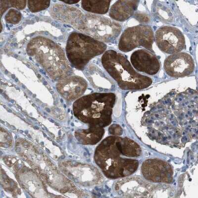 Immunohistochemistry-Paraffin: TMEM41B Antibody [NBP1-81552] - Staining of human Kidney shows strong granular cytoplasmic positivity in cells in tubules.