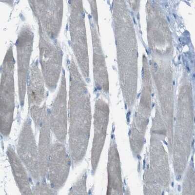 Immunohistochemistry-Paraffin: TMEM41B Antibody [NBP1-81552] - Staining of human Skeletal muscle shows no granular cytoplasmic positivity in myocytes as expected.