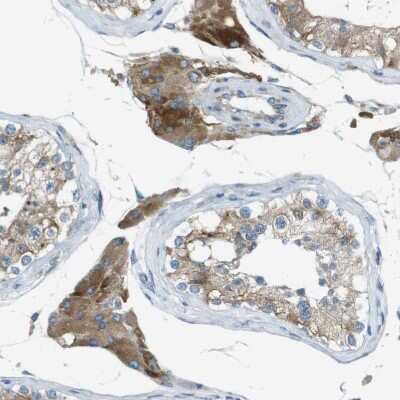Immunohistochemistry-Paraffin: TMEM41B Antibody [NBP1-81552] - Staining of human Testis shows moderate granular cytoplasmic positivity in Leydig cells.
