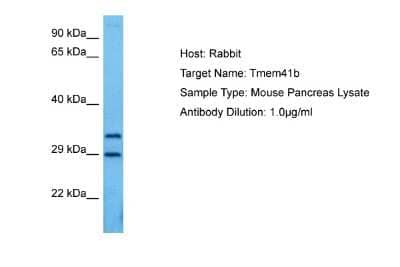 Western Blot: TMEM41B Antibody [NBP2-83692] - Host: Rabbit. Target Name: TMEM41B. Sample Tissue: Mouse Pancreas lysates. Antibody Dilution: 1ug/ml