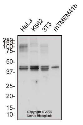 Western Blot: TMEM41B Antibody [NBP3-00527] - Total protein from human HeLa and K562 cells, mouse 3T3 cells and recombinant human TMEM41b protein (H00440026-p01) were separated on a 12% gel by SDS-PAGE, transferred to PVDF membrane and blocked in 5% non-fat milk in TBST. The membrane was probed with 2.0 ug/ml anti-TMEM41b (NBP3-00527) in blocking buffer and detected with an anti-rabbit HRP secondary antibody using NovaLume chemiluminescence detection reagent (NPB2-61915).