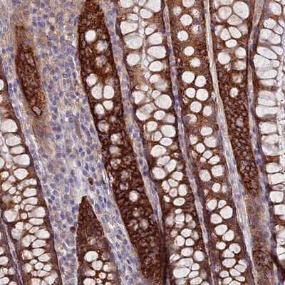 Immunohistochemistry-Paraffin: TMEM44 Antibody [NBP1-90507] - Staining of human rectum shows strong cytoplasmic positivity in glandular cells.