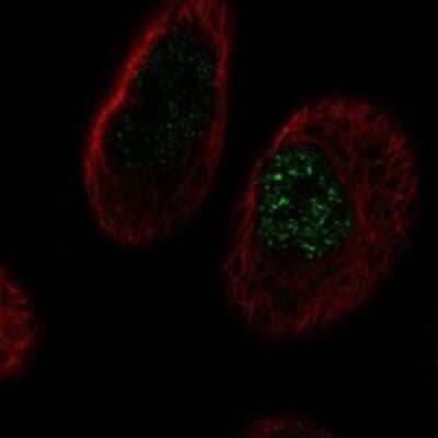 Immunocytochemistry/Immunofluorescence: TMEM45B Antibody [NBP3-17632] - Staining of human cell line PC-3 shows localization to nucleoplasm.