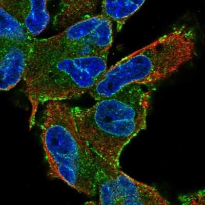 Immunocytochemistry/Immunofluorescence: TMEM48 Antibody [NBP2-57872] - Staining of human cell line RH-30 shows localization to nuclear membrane, plasma membrane & actin filaments. Antibody staining is shown in green.