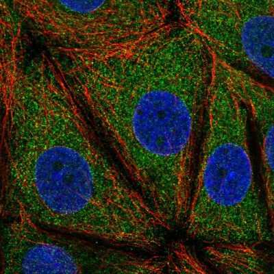 Immunocytochemistry/Immunofluorescence: TMEM49 Antibody [NBP2-58456] - Staining of human cell line MCF7 shows localization to endoplasmic reticulum.