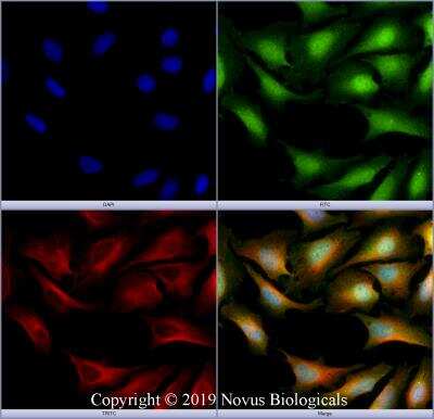 Immunocytochemistry/ Immunofluorescence TMEM49 Antibody - BSA Free