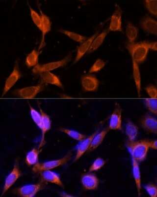 Immunocytochemistry/Immunofluorescence: TMEM49 Antibody [NBP2-93149] - Analysis of NIH-3T3 cells using TMEM49 . Blue: DAPI for nuclear staining.