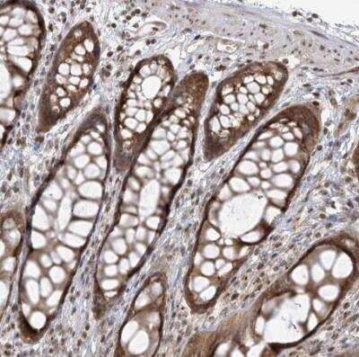 Immunohistochemistry-Paraffin: TMEM49 Antibody [NBP1-83971] - Staining of human rectum shows moderate cytoplasmic positivity in glandular cells.