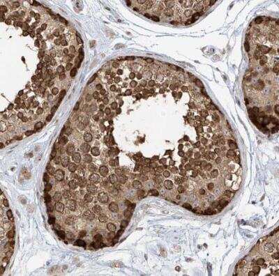 Immunohistochemistry-Paraffin: TMEM49 Antibody [NBP1-83971] - Staining of human testis shows strong cytoplasmic positivity in cells in seminiferous ducts.