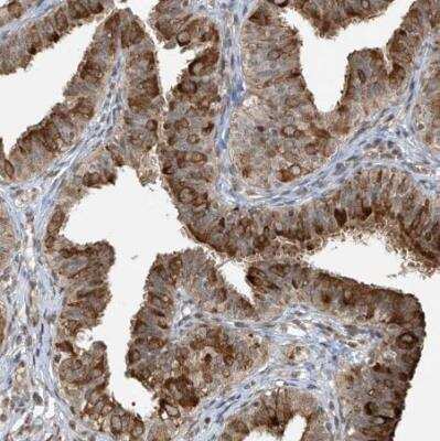 Immunohistochemistry-Paraffin: TMEM49 Antibody [NBP1-83971] - Staining of human fallopian tube shows strong cytoplasmic positivity in glandular cells.