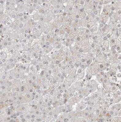 Immunohistochemistry-Paraffin: TMEM49 Antibody [NBP1-83971] - Staining of human liver shows negative to very weak cytoplasmic positivity in hepatocytes.